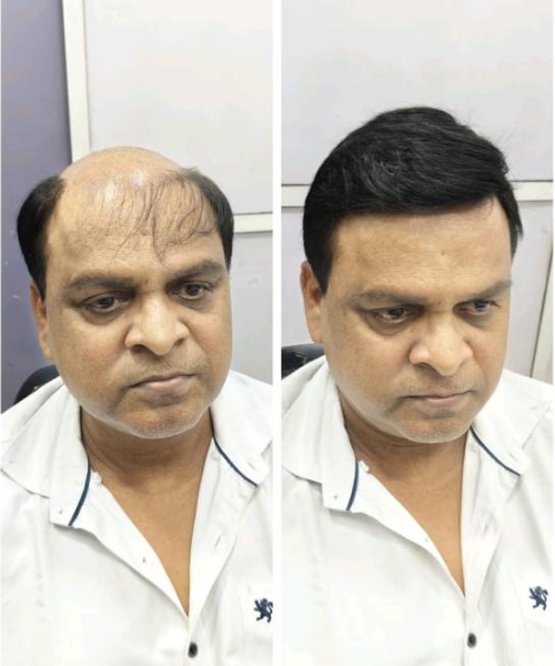 Hair extensions colour match, Hercovits Santacruz